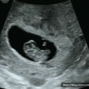 윤은숙산부인과의원 이미지