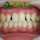 허브치과기공소 티스토리