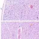 가물치의 간장 출혈의 원인 Bacillus cereus 이미지