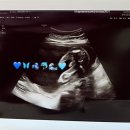 배꼽안복법서울교실 | 7월 ~3주차 | 건강하세요! 그래야만...행복도 있답니다