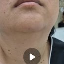 더레이디