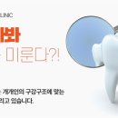 애프터기공소 이미지