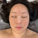 위드미 구미인동점 | 구미피부관리 인동 선샤인미뷰티케어 수분 채움 관리