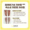 주상연드림가정의학과의원 | 다리, 허벅지, 발목 점상출혈? 한 쪽만 나타났다면 '이것' 2가지 확인하세요.