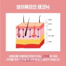 바비스킨케어 네이버블로그