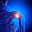 성모퍼스트정형외과의원 이미지