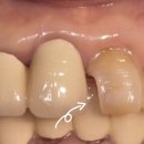 이랑치과기공소 이미지