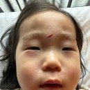 연세세인트성형외과의원 이미지