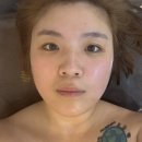 엔젤스킨케어 | 사각턱 고민해결 인덕원 시크릿윤곽관리 찐후기 전후사진있음 플로라스킨케어
