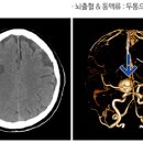 두미소신경과의원 이미지