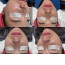 주공3차 사거리 | 천안피부관리 오마주 스킨케어