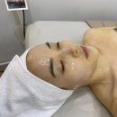 평촌 피부관리 후기 '리컴뷰티'