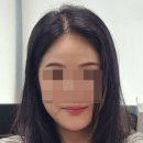 논현정한의원 | 강남 안면비대칭한의원 상담, 교정 솔직후기(비포/애프터 사진)