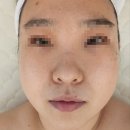 다산 에스테틱 사바비안에서 메인토탈케어 받고 온 후기