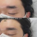베러일쩜일