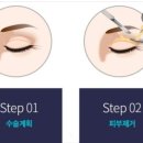 더원외과 | ​📍 [대구 성형외과 투어 완결]20군데 돌고 결정한 솔직 리뷰 (ft. 내돈내산)