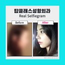 탑클래스성형외과의원 이미지