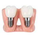 오만용치과의원 | 입 찢어지는 고민 끝판왕! 찐으로 인생 갈아 넣은 후기