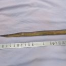 "50cm 장어가 직장 뚫고 들어가" 급성 복막염 쇼크 발생… 대체 무슨 일?﻿ 이미지