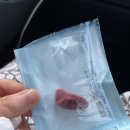 사랑니는 류치과 🦷