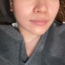 생성공간 | 선릉역 피부과 쥬베룩볼륨으로 콜라겐생성, 앞광대 옆볼 채우기 내돈내산 후기