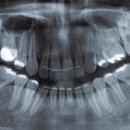 바른플란트치과교정과치과의원 이미지