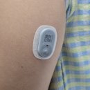 최가영 | 30대 당뇨전단계 연속혈당측정기 추천 필라이즈 슈가케어 케어센스 에어 2주 후기