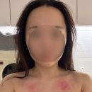 피부맑음 | 자양동 피부관리 오늘피부맑음에서 비대칭 속건조 물방울LDM 프로그램 받고 온 후기