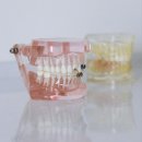 서울오케이치과의원 별가람점 | 수면치과, 기능과 모양을 살리는 크라운 치료