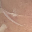 코아메디칼 | 부산신부관리 받고 느낀 “얼굴 붓기 빠지면 분위기 자체가 달라지는구나” 서면윤곽관리 코아페이즈 후기