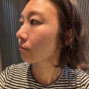[뷰티]인천 구월동 피부과 콜라겐 주사 미라콜후기