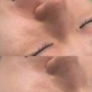 (유)사선환경 | [뽈뽈리뷰]한끗에스테틱 - 피부상태에 따른 커스텀 피부관리 추천 / 서면피부관리