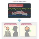 희귀질환 및 중증난치질환의 정의[희귀난치성질환 산정특례 진단비(치매 제외) 특별약관] 이미지