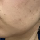 대해 | 리포좀 글루타치온에 대해 직접 찾아본 후기