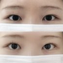 신갈마로-10 | 대전 서구 갈마동 속눈썹펌 오래가고 잘하는곳 벨모아뷰티 후기