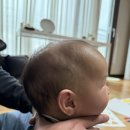 교수님 판독부탁드립니다. 이미지