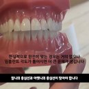 연합치과기공소 이미지