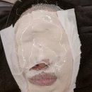 광주 수완지구 윤곽관리 얼굴 작아지는 마법 예라인에스테틱