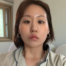 다온다옴 | 청담동 피부과 리프팅 투어, 온다 티타늄 시너지보고옴
