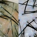 늘품로3 | 원주 두피클리닉, 숲칼프 두피 클리닉 후기