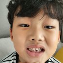 이세치과의원 | 안산 고잔 키즈치과 처음가는소아치과의원 첫 유치 발치