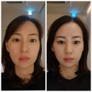 세르모소에스테틱 이미지