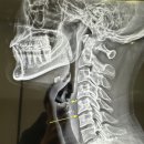 서울휴재활의학과의원 | 목디스크 도수치료 | 신당동 서울휴재활의학과 추천! 목 뻐근함 탈출