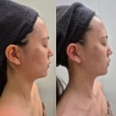 유성메디칼케어 | 대전 웨딩케어 스킨앤토크 윤곽 피부 신부관리 솔직후기