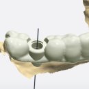 애플치과기공소 이미지