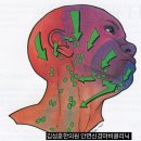 오래된 구안와사/ 구안와사 후유증의 치료법 김성훈한의원 이미지