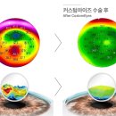 커스텀아이즈 이미지