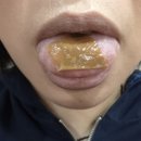 케이디 | 닥터케이디 여름구강관리, 프로유더블 하루 한 장 루틴 후기