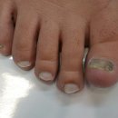 아이캔네일 이미지