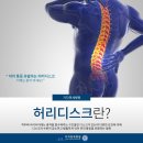 김포정형외과 지속되는 허리통증 다리 저림이 동반된다면 허리디스크 의심 이미지